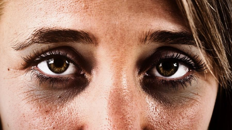 Sol, rinite, colesterol: conheça 10 causas de inchaço nos olhos e olheiras  - 23/01/2023 - UOL VivaBem