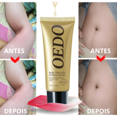 Creme Redutor de Estrias e Manchas - OEDO