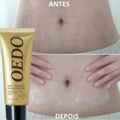 Creme Redutor de Estrias e Manchas - OEDO