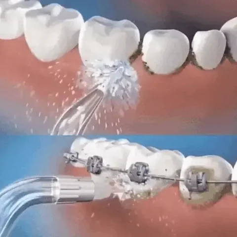 Irrigador Oral para Limpeza Bucal - CleanJet